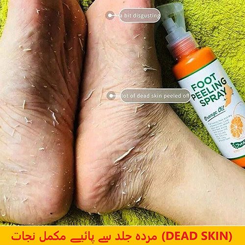 Foot Peeling Spray For Dead Skin